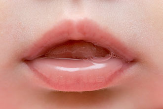 宝宝嘴唇干裂越补水越干燥？1碗粥解决它